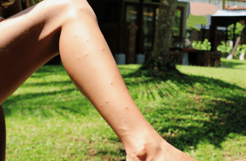 покусали блохи