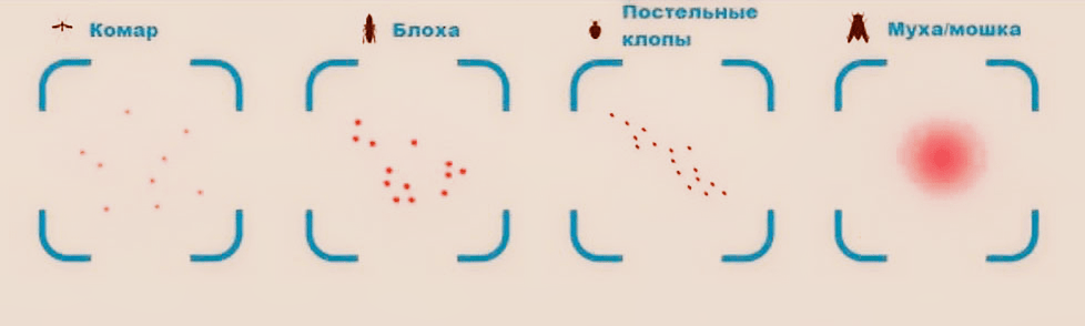 отличие укусов блох